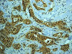 Immunohistochemistry (Formalin/PFA-fixed paraffin-embedded sections) - Anti-PKC zeta (phospho T560) antibody [EP2037AY] (AB62372)