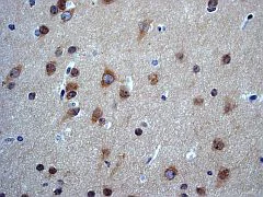 Immunohistochemistry (Formalin/PFA-fixed paraffin-embedded sections) - Anti-PKC zeta (phospho T560) antibody [EP2037AY] (AB62372)