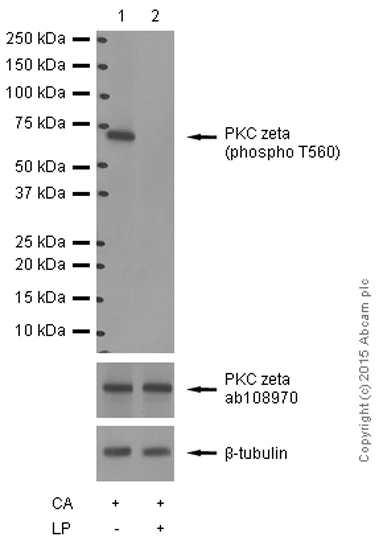 Western blot - Anti-PKC zeta (phospho T560) antibody [EP2037AY] (AB62372)