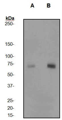 Western blot - Anti-PKC zeta (phospho T560) antibody [EP2037AY] (AB62372)