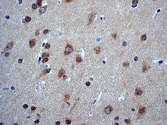 Immunohistochemistry (Formalin/PFA-fixed paraffin-embedded sections) - Anti-PKC zeta (phospho T560) antibody [EP2037AY] - BSA and Azide free (AB236001)