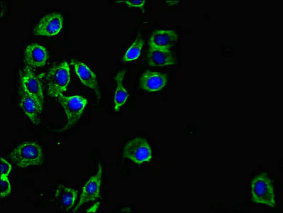 Immunocytochemistry/ Immunofluorescence - Anti-PKD1L3 antibody (AB234670)