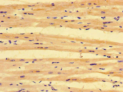 Immunohistochemistry (Formalin/PFA-fixed paraffin-embedded sections) - Anti-PKD1L3 antibody (AB234670)