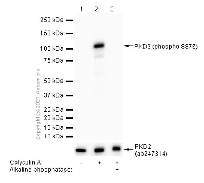 Western blot - Anti-PKD2 (phospho S876) antibody [EP1496Y] (AB51251)