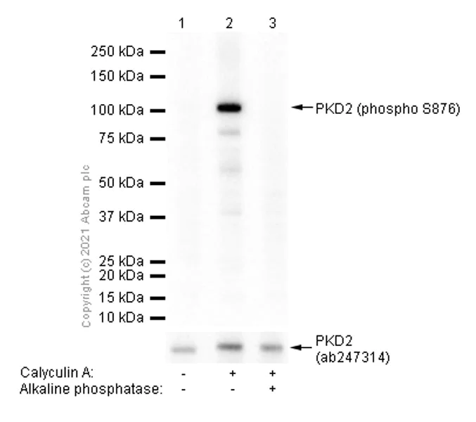 Western blot - Anti-PKD2 (phospho S876) antibody [EP1496Y] - BSA and Azide free (AB246493)