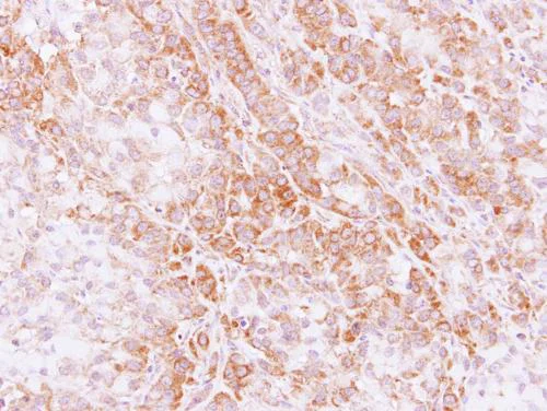 Immunohistochemistry (Formalin/PFA-fixed paraffin-embedded sections) - Anti-PKE antibody (AB153917)