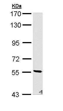 Western blot - Anti-PKE antibody (AB153917)