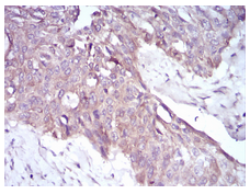 Immunohistochemistry (Formalin/PFA-fixed paraffin-embedded sections) - Anti-PKHD1 antibody [8G12A1] (AB204951), expandable thumbnail
