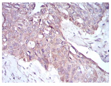 Immunohistochemistry (Formalin/PFA-fixed paraffin-embedded sections) - Anti-PKHD1 antibody [8G12A1] (AB204951)
