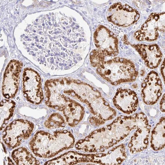Immunohistochemistry (Formalin/PFA-fixed paraffin-embedded sections) - Anti-PKHD1 antibody (AB122160), expandable thumbnail