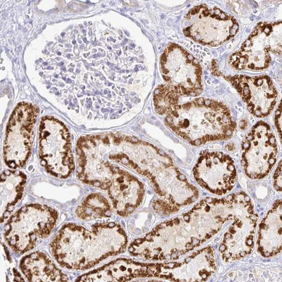 Immunohistochemistry (Formalin/PFA-fixed paraffin-embedded sections) - Anti-PKHD1 antibody (AB122160)