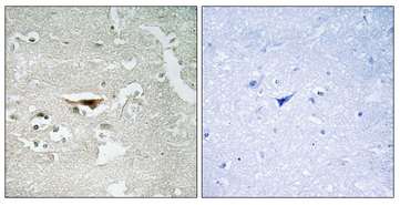 Immunohistochemistry (Formalin/PFA-fixed paraffin-embedded sections) - Anti-PKIB antibody (AB196689), expandable thumbnail
