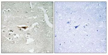 Immunohistochemistry (Formalin/PFA-fixed paraffin-embedded sections) - Anti-PKIB antibody (AB196689)