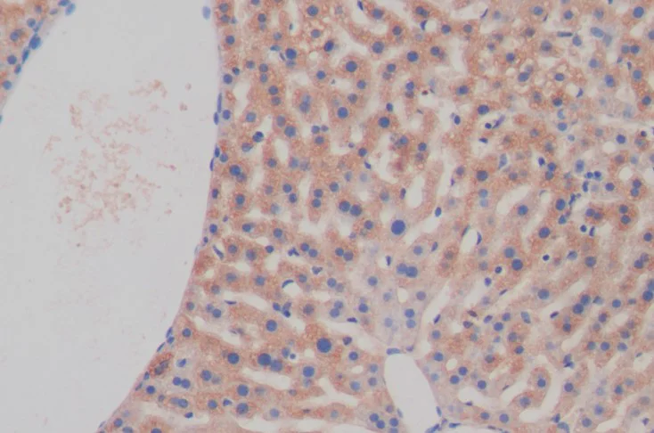 Immunohistochemistry (Formalin/PFA-fixed paraffin-embedded sections) - Anti-PKIB antibody (AB233521)