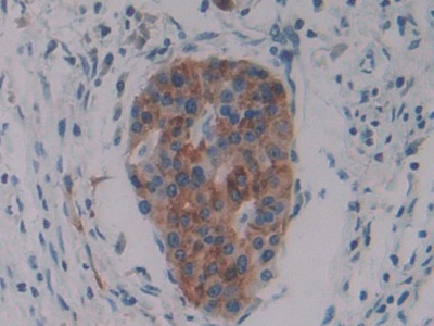 Immunohistochemistry (Formalin/PFA-fixed paraffin-embedded sections) - Anti-PKIB antibody (AB233521)
