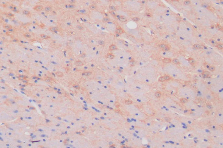 Immunohistochemistry (Formalin/PFA-fixed paraffin-embedded sections) - Anti-PKIB antibody (AB233521)