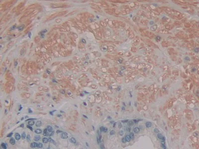 Immunohistochemistry (Formalin/PFA-fixed paraffin-embedded sections) - Anti-PKIB antibody (AB233521)