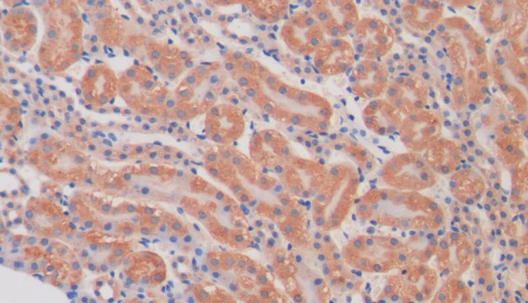Immunohistochemistry (Formalin/PFA-fixed paraffin-embedded sections) - Anti-PKIB antibody (AB233521)