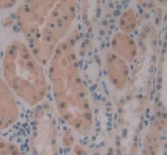 Immunohistochemistry (Formalin/PFA-fixed paraffin-embedded sections) - Anti-PKIB antibody (AB233521)