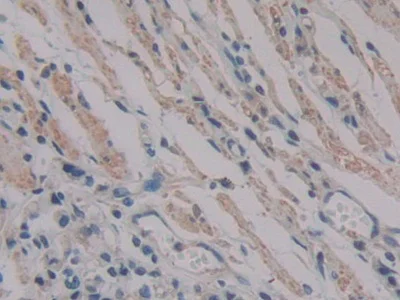 Immunohistochemistry (Formalin/PFA-fixed paraffin-embedded sections) - Anti-PKIB antibody (AB233521)