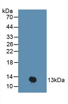 Western blot - Anti-PKIB antibody (AB233521)