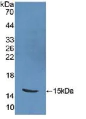 Western blot - Anti-PKIB antibody (AB233521)