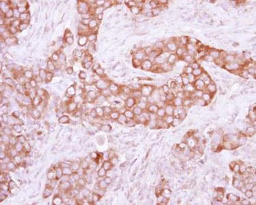 Immunohistochemistry (Formalin/PFA-fixed paraffin-embedded sections) - Anti-PKLR antibody (AB125697)