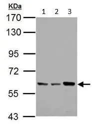 Western blot - Anti-PKLR antibody (AB125697)