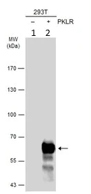 Western blot - Anti-PKLR antibody (AB125697)