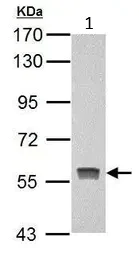 Western blot - Anti-PKLR antibody (AB125697)
