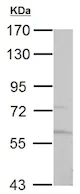 Western blot - Anti-PKLR antibody (AB137787)