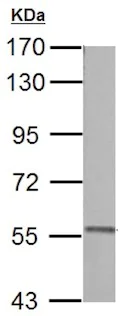 Western blot - Anti-PKLR antibody (AB137787)