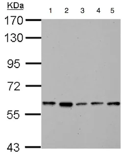 Western blot - Anti-PKLR antibody (AB137787)