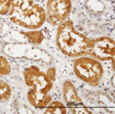 Immunohistochemistry (Formalin/PFA-fixed paraffin-embedded sections) - Anti-PKLR antibody (AB89071)