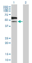 Western blot - Anti-PKLR antibody (AB89071)