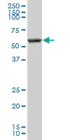 Western blot - Anti-PKLR antibody (AB89071)