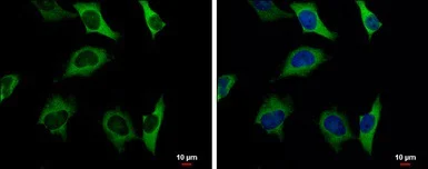 Immunocytochemistry/ Immunofluorescence - Anti-PKLR antibody (AB96604)