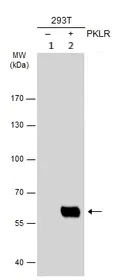 Western blot - Anti-PKLR antibody (AB96604)