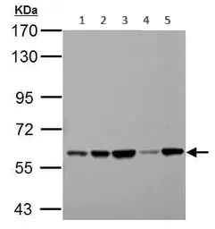 Western blot - Anti-PKLR antibody (AB96604)