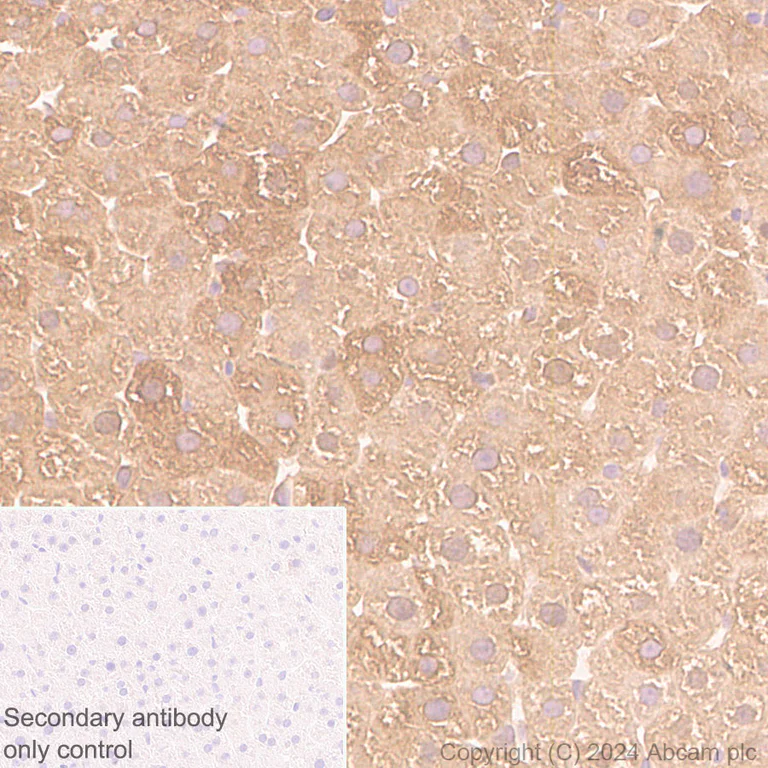 Immunohistochemistry (Formalin/PFA-fixed paraffin-embedded sections) - Anti-PKLR antibody [EPR11093] (AB171744)