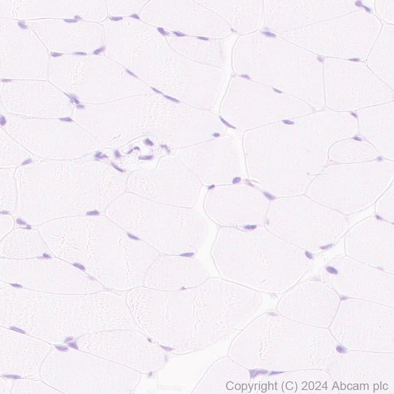 Immunohistochemistry (Formalin/PFA-fixed paraffin-embedded sections) - Anti-PKLR antibody [EPR11093] (AB171744)