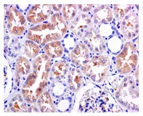 Immunohistochemistry (Formalin/PFA-fixed paraffin-embedded sections) - Anti-PKLR antibody [EPR11093] (AB171744)