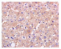 Immunohistochemistry (Formalin/PFA-fixed paraffin-embedded sections) - Anti-PKLR antibody [EPR11093] (AB171744)