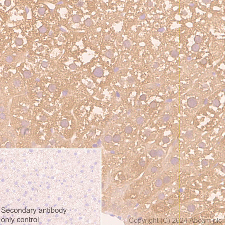 Immunohistochemistry (Formalin/PFA-fixed paraffin-embedded sections) - Anti-PKLR antibody [EPR11093] - BSA and Azide free (AB249648)