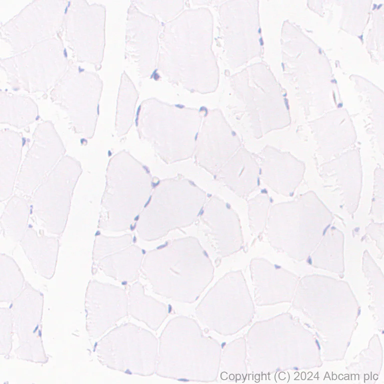 Immunohistochemistry (Formalin/PFA-fixed paraffin-embedded sections) - Anti-PKLR antibody [EPR11093] - BSA and Azide free (AB249648)