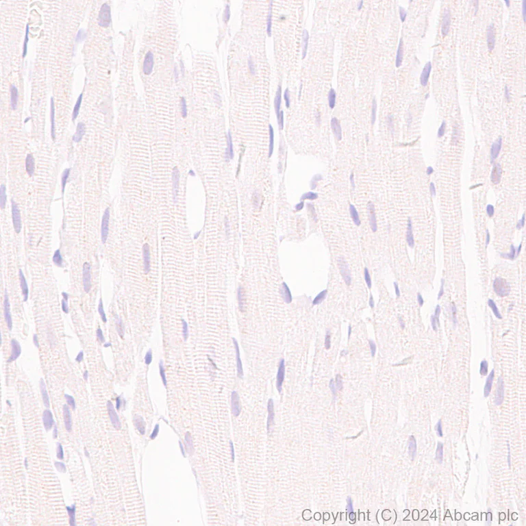 Immunohistochemistry (Formalin/PFA-fixed paraffin-embedded sections) - Anti-PKLR antibody [EPR11093] - BSA and Azide free (AB249648)