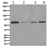 Western blot - Anti-PKLR antibody [EPR11093] - BSA and Azide free (AB249648)
