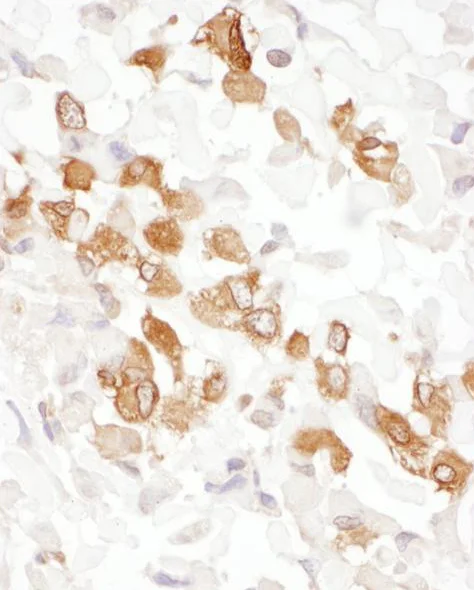 Immunohistochemistry (Formalin/PFA-fixed paraffin-embedded sections) - Anti-PKM antibody (AB131021)