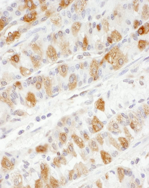 Immunohistochemistry (Formalin/PFA-fixed paraffin-embedded sections) - Anti-PKM antibody (AB131021)