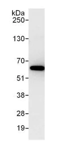 Immunoprecipitation - Anti-PKM antibody (AB131021)